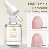 nail cuticle remover
